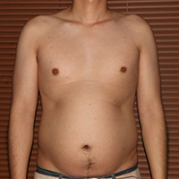デブ画像前 デブの2週間ダイエット日記25日目