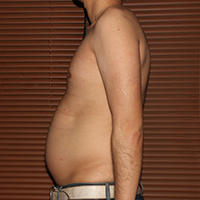 デブ画像左横 デブの2週間ダイエット日記29日目