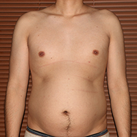 デブ画像前 デブの2週間ダイエット日記31日目