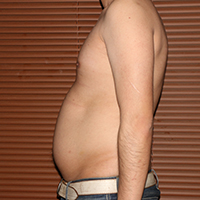 デブ画像左横 デブの2週間ダイエット日記19日目